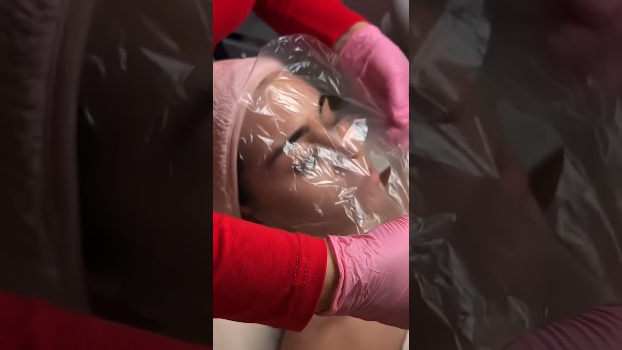 Best Facial Treatments for Radiant & Healthy Skin | Primavera Clinic Brisbane 