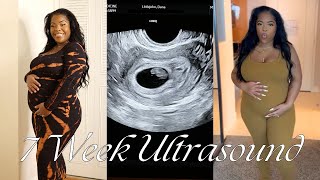 Our First Doctors Appointment &amp; Ultrasound | Pregnancy Vlog | Our first trimester Vlog