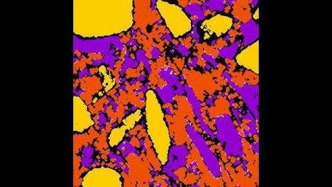 Region Growing Segmentation by succesive dilations. X ray computed tomography