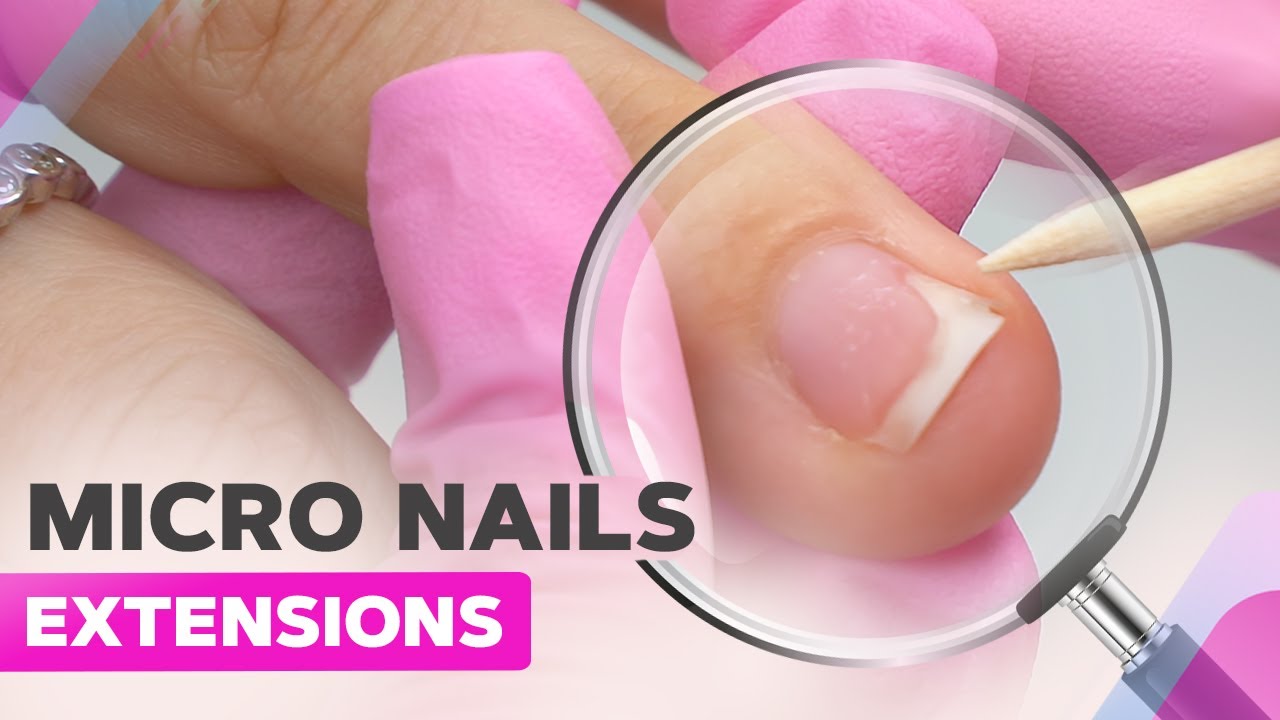Mini Nail Extensions Onycholysis Expert Tips on Nails Growing