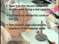 Complete denture procedure  12 max wax occlusion rims
