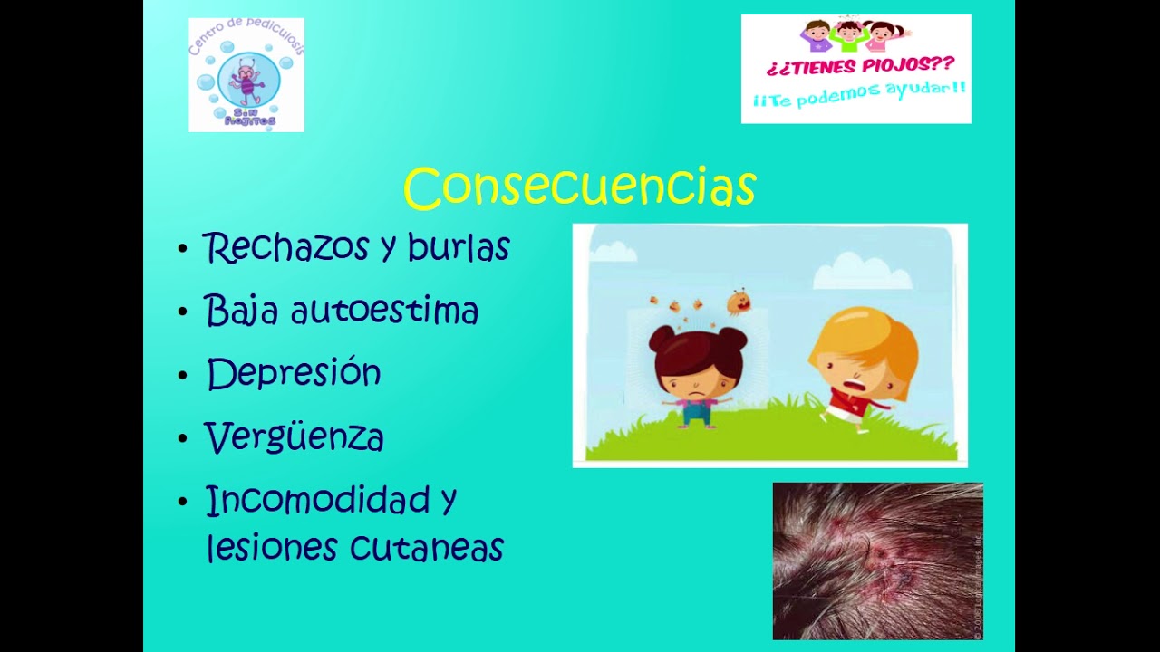 causas y tratamiento de pediculosis