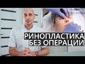 🔥Безоперационная ринопластика❗️Как выбрать филлер для коррекции носа?❗️❗️