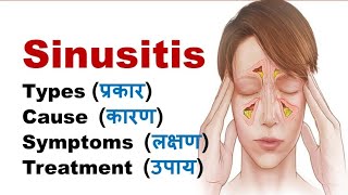 Sinusitis - Types, Causes, Symptoms, Treatment | Sinuses