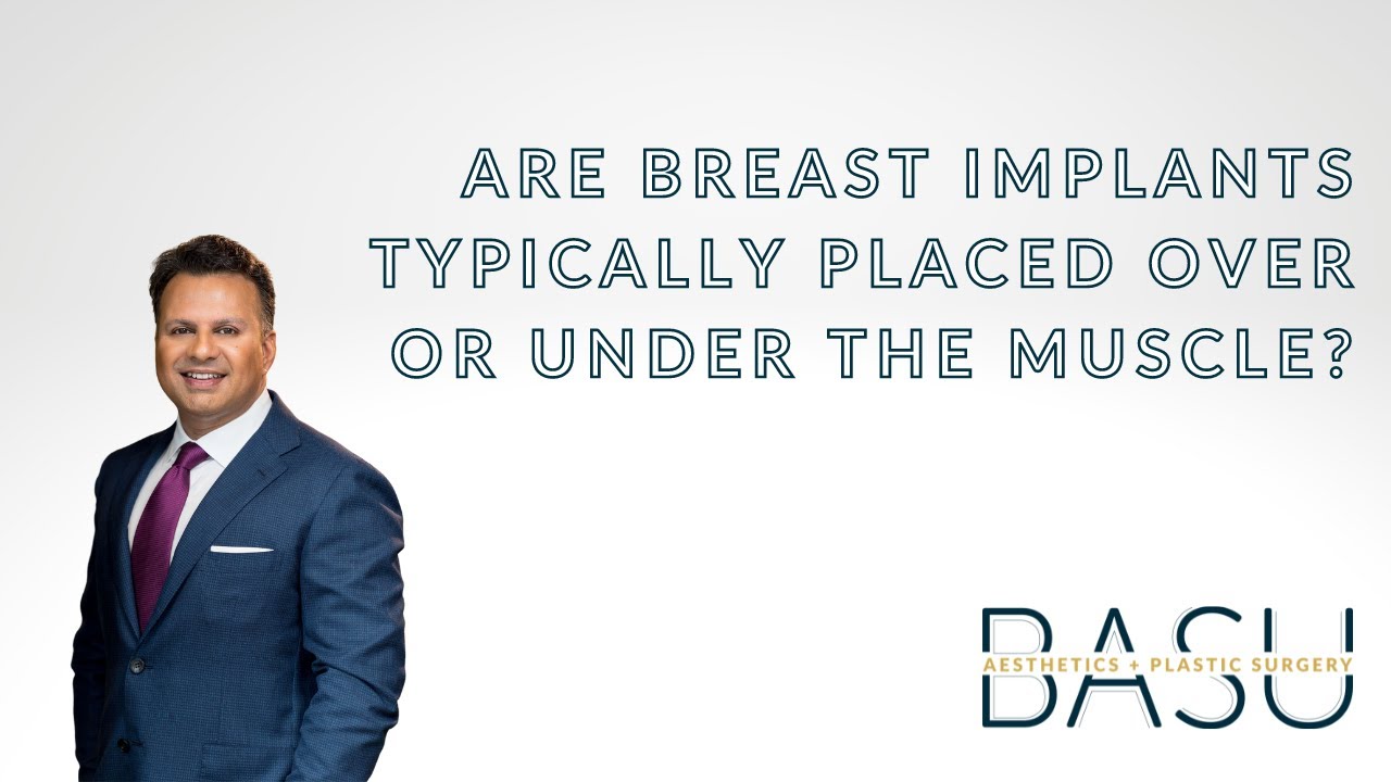 Are breast implants typically placed over or under the muscle? 