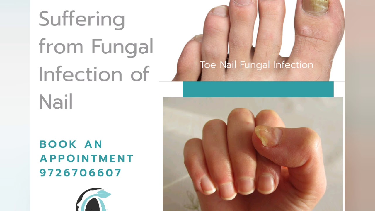 Best Dermatologist in Surat - YouTube