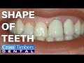 Shape of teeth: The Cosmetic Quadrant