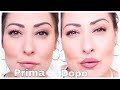 COME INGRANDIRE LE LABBRA CON IL TRUCCO  overline per labbra più grandi e volumizzate #lips