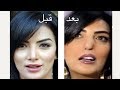 فنانات اجرت عمليات تجميل فاشلة