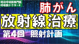 放射線の照射計画