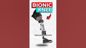 Wetenschappers creëren levensechte bionische knie