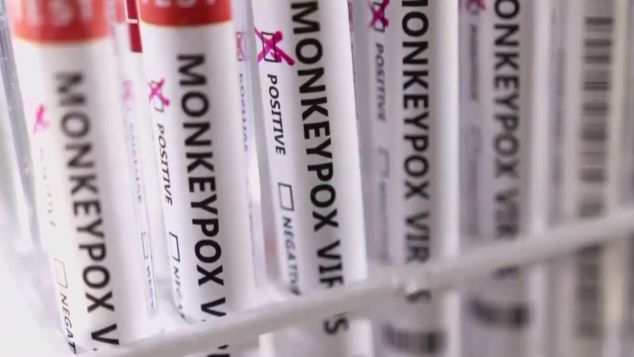 Menasha confirms its first case of monkeypox, transmission risk remains low