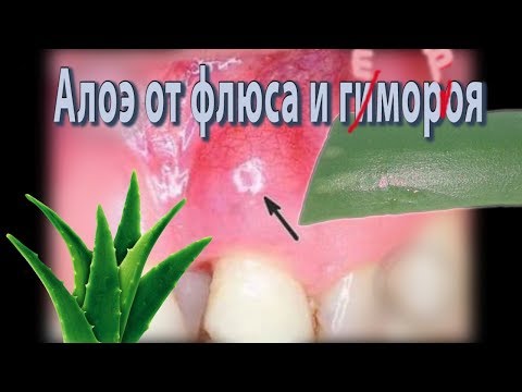 Video: Što Aloe Vera Može Učiniti Za Desni?