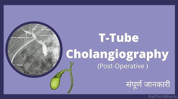 T-Tube Cholangiography Radiology in Hindi