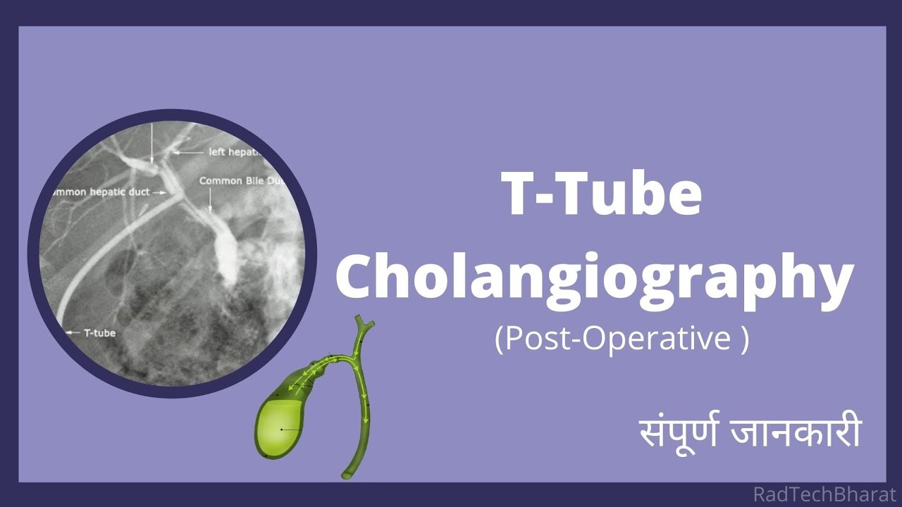 TTube Cholangiography Radiology in Hindi YouTube