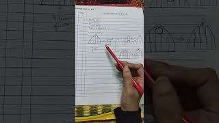 Dimpling, Pickering, Tethering, Retraction Of Breast Concept Of Breast