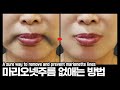 [Eng] 마리오넷주름 확실한 예방법!! / 입꼬리 처짐 / 불독살 / 심술보 / How to get rid of marionette wrinkles.