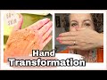 AGING TO AMAZING // My IPL Hand Treatment: Oh &amp; IPL on my Face