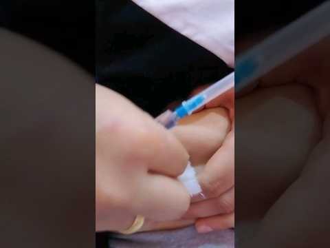 حقنه عضل ديكسا