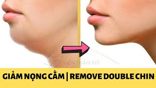 Bạn bị NỌNG CẰM, hai cằm? Hãy thử BT Face Yoga  xóa nọng cằm này | Massage xóa NỌNG CẰM hiệu quả