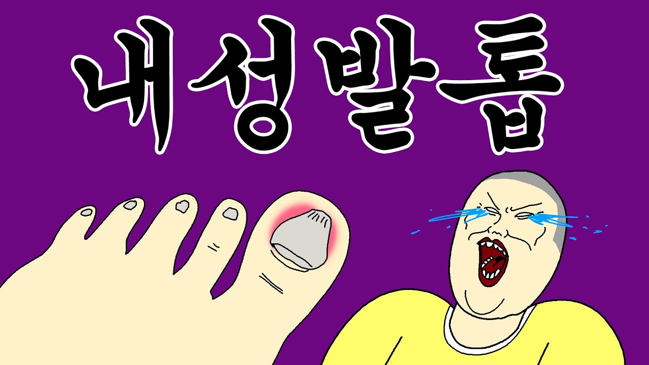 [짤툰 오리지널] 내성 발톱 - YouTube