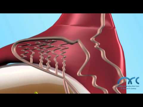 male-reproductive-system-india.-top-male-fertility-&-sexual-clinic,-andrologist&-sexologist-chennai