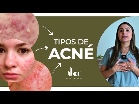 ¿Cuáles son los