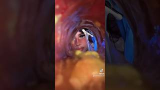 What Is That? Dirtiest Ears Everpt.3