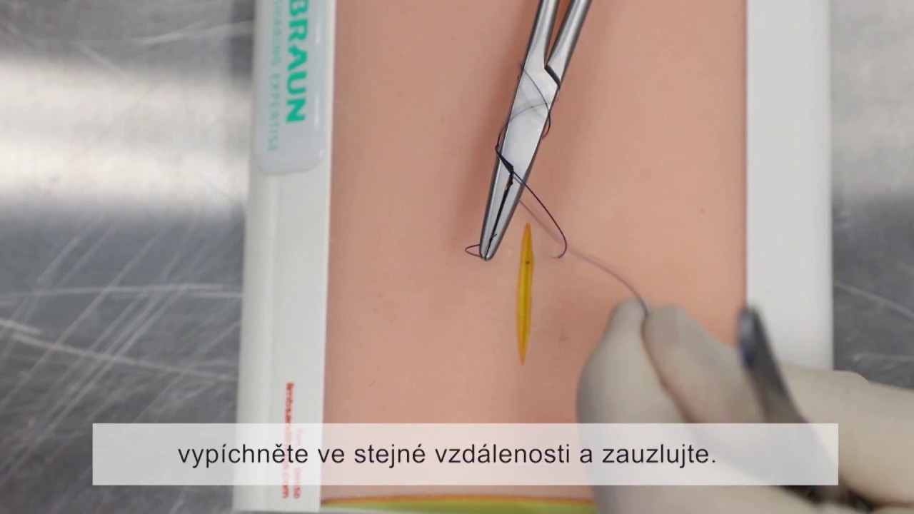 Chirurgické stehy: Obyčejný steh (top view)