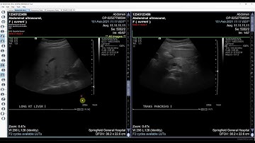 Reading cases on the OnePacs system