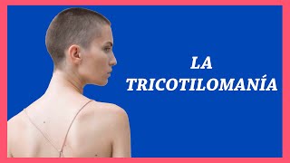 21. La Tricotilomanía (trastorno de arrancarse el pelo) Serie Trastornos Relacionados con el TOC #4|