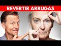 Cómo Reducir Arrugas y Líneas de Expresión