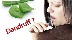 Get rid of your Dandruff using Aloe Vera, Cure Chronic Dandruff WIth Aloe Vera How TO Use At Home, HOW TO STOP DRY SCALP & DANDRUFF | Aloe Vera Scalp Treatment, Dandruff treatment at Home with ALOE VERA | 💯% Cure For Dandruff & Hair Fall, Benefits of Aloevera on your Hair. Anti Dandruff. Soft, Silky, Bouncy Hair