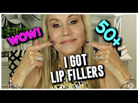 MY NATURAL LOOKING LIP FILLERS | GO WITH ME AS I GET LIP INJECTIONS!!