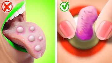 Cô Bé Nghèo Vs Cô Bé Giàu Trong Bệnh Viện || Các Mẹo Điên Rồ & Tình Huống Hài Hước Gần Gũi