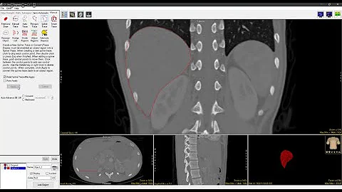 Analyze 15.0 - Segment: Spline Trace