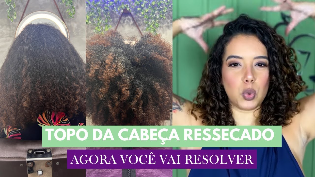 TOPO DA CABEÇA EXTREMAMENTE RESSECADO E POROSO - Tamires Maia