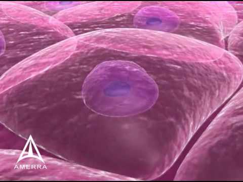 Sanuwave - Dermapace 3D Medical Device Animation