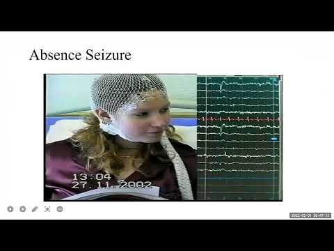 Diagnosis Kejang dan epilepsi part 1