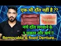 एक भी दाँत न हो तो नए दाँत लगाने के 3 प्रकार और खर्च ! 3 options to replace teeth (Complete Denture)