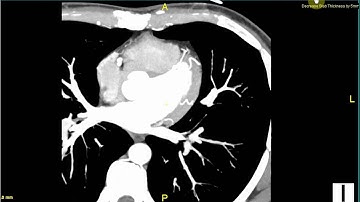 Inbuilt 3D Feature - Saince Merge PACS