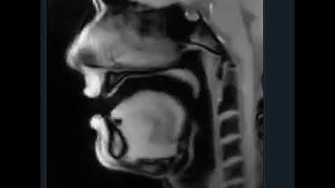 MRI shows what your tongue looks like when you speak