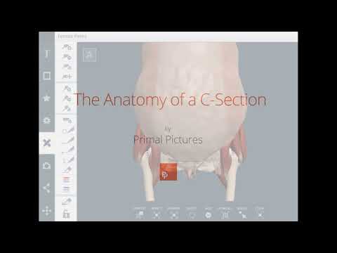 Primal Pictures: C-section