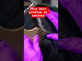 This Hair Problem Is Serious Scalppsoriasis Scalppsoriasisremoval Scalpdandruff MadPASMR 