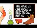 Burn Management for NREMT - Thermal, Chemical and Electrical Burns