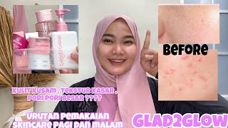 Urutan Pemakaian Skincare Glad2Glow Siang Dan Malam Hari Cara Pakai Skincare Glad2Glow