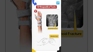 Must Know Tests In Orthopedics