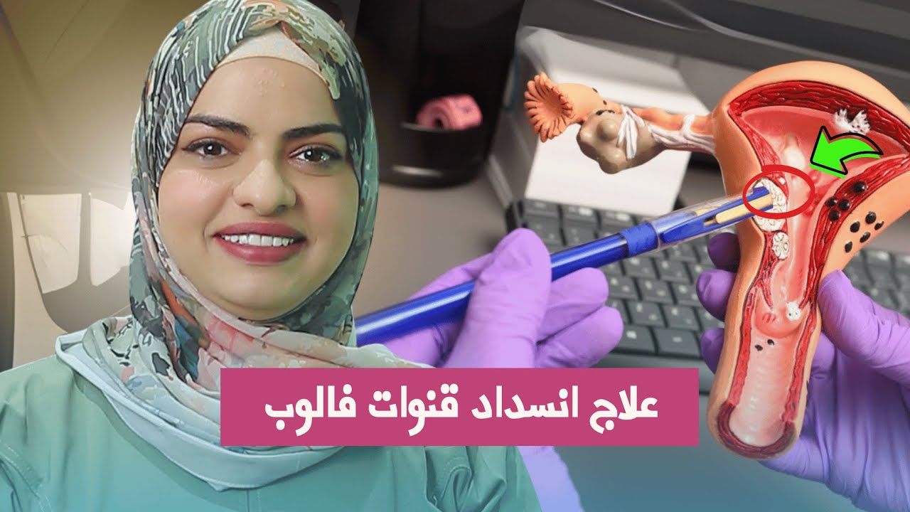 5 طرق تساعدك على علاج انسداد قنوات فالوب؟ الطريقة الثالثة رح تفاجئك! لا تفقدي الأمل