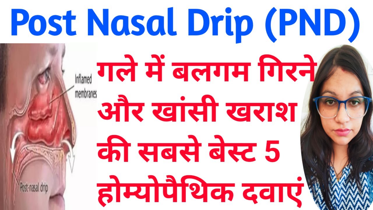 Post Nasal Drip (PND) Post Nasal Drip Homeopathic Treatment गले में