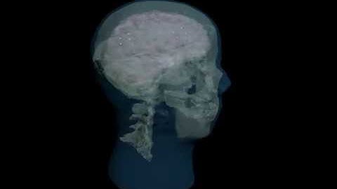 Design Video: Adult Head (Static) for X-Ray CT, US, MRI